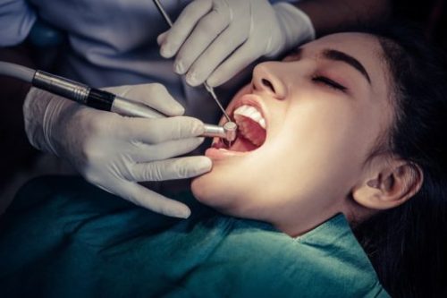 Root canal treatment at dentist