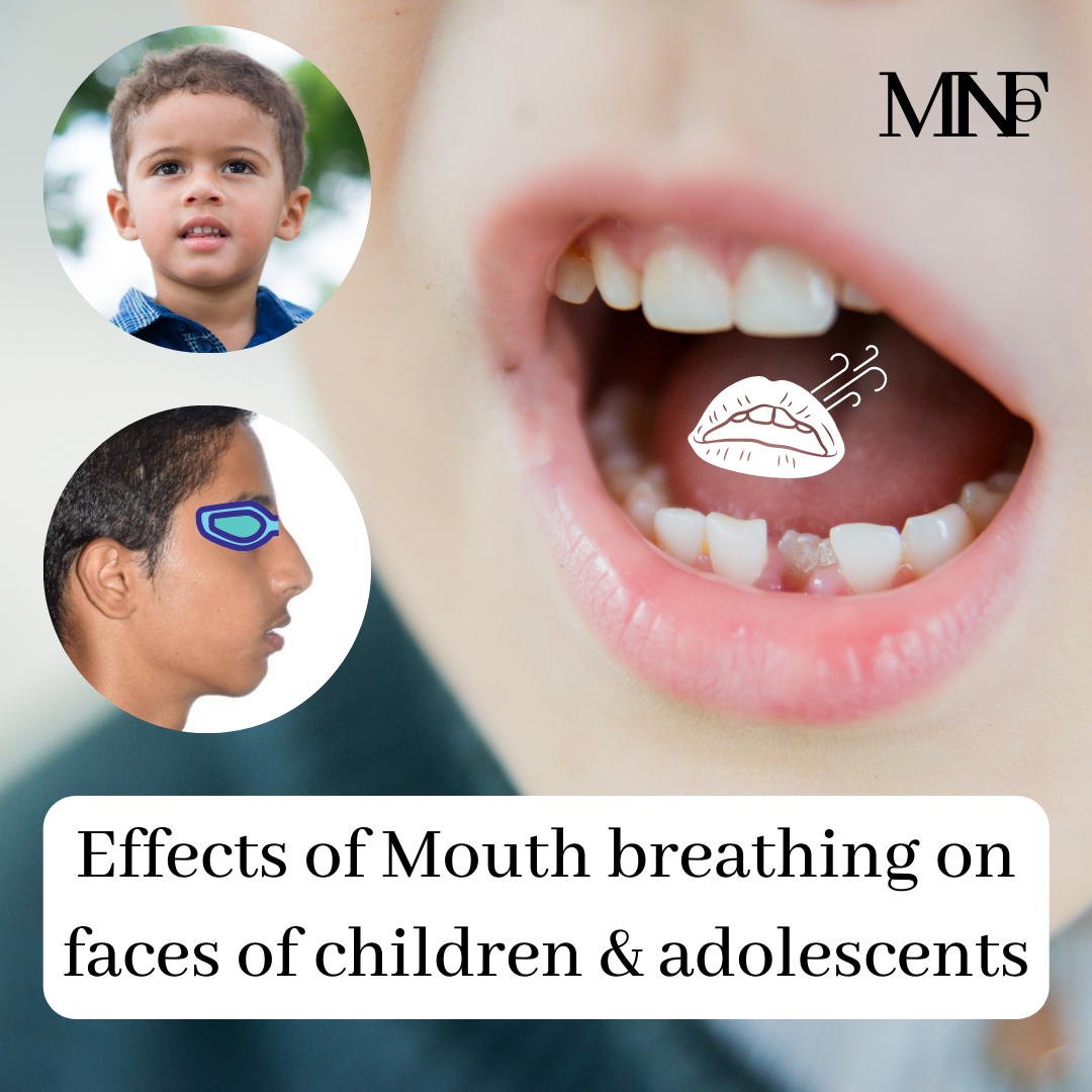 Effects of mouth breathing on faces