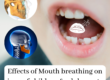 Mouth breathing effects on Jaws